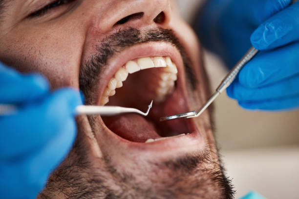 Best Emergency Denture Repair in St Helens, OR